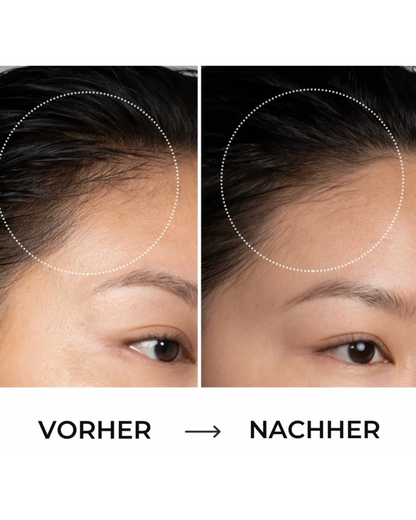 Nolina® Kopfhaut-Pflegebürste 3-in-1